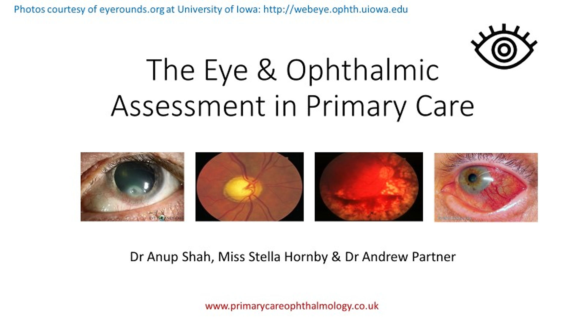 The Eye & Ophthalmic Assessment in Primary Care